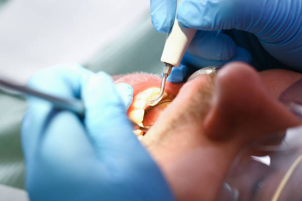 Best Broken or Cracked Tooth Emergency Dentist in Shoreacres, TX