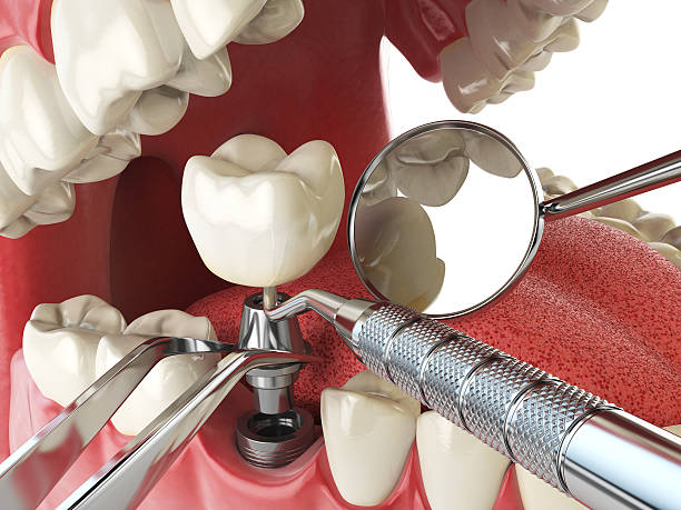 Best Emergency Dental Services for Seniors in Shoreacres, TX